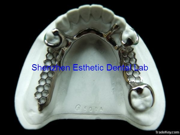 Dental metal partial framework