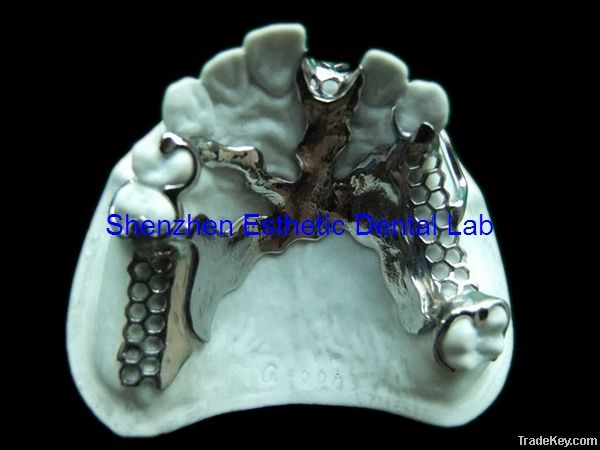 Dental metal partial framework