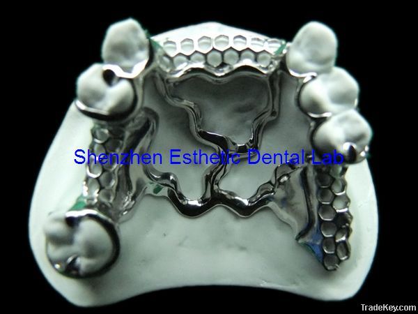 Dental metal partial framework