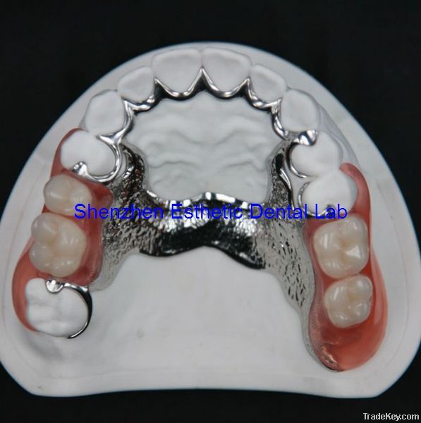 Dental Acrylic Denture