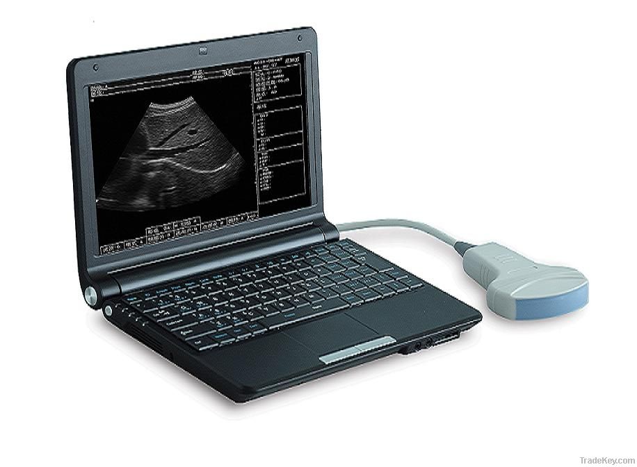 SW-1200A  Laptop ultrasound scanner