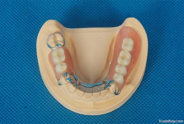 Dental removable CCP Metal Framework Supply