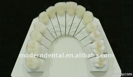 Dental full ceramic (all-porcelain) emax Crown