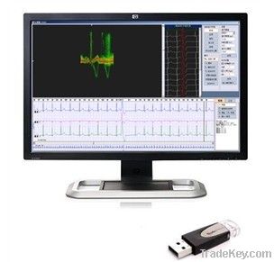 Holter analysis software