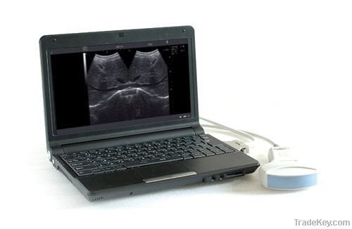 CX 6100B Notebook digital diagnostic ultrasound system for human and v