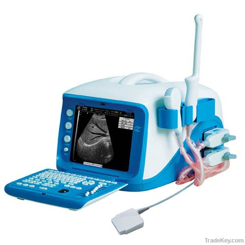 CX6000 Portable digital ultrasound scanner