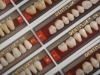 Denti'lux acrylic resin teeth
