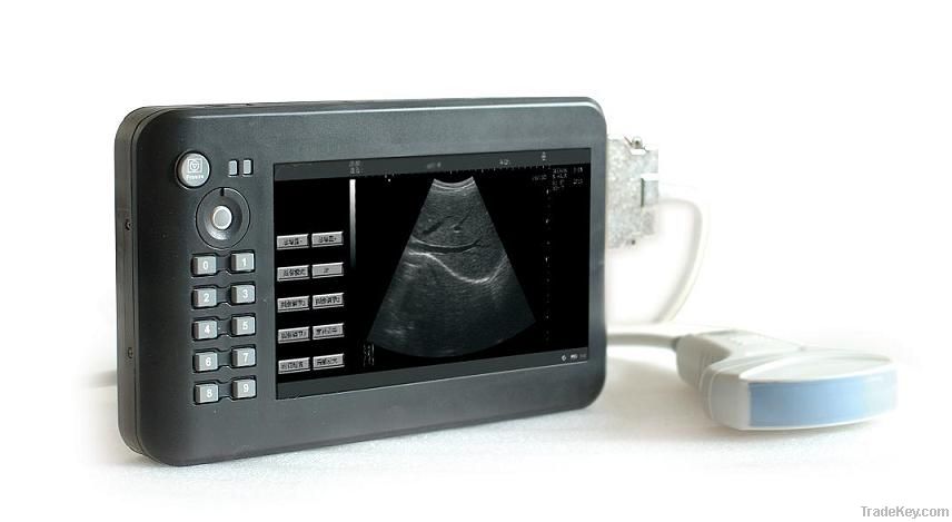 Hand carried digital diagnostic Ultrasound System