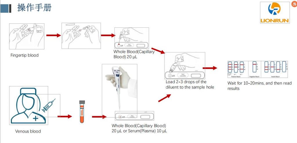 Diagnostic Kit for Antibody IgM/IgG of Novel Coronavirus COVID-19