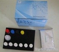 Human Fibrinogen(FB) ELISA Kit