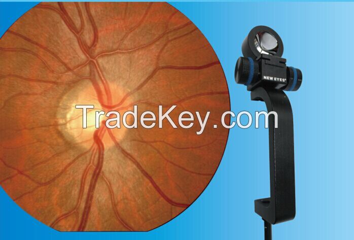 Retinal Viewing System For Slit Lamps