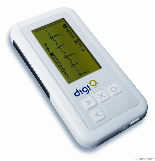 Single-lead ECG monitor