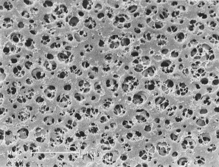 Cellulose acetate membranes