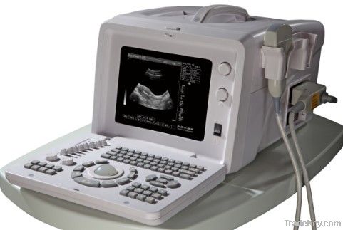 Ultrasound scanner