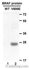 Anti-B-Raf(V600E) Mouse Monoclonal Antibody