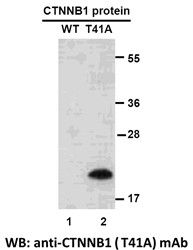 Anti-CTNNB1 (T41A) Mouse Monoclonal Antibody