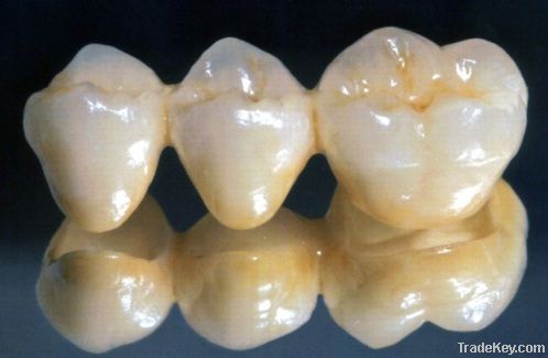 Sell PFM Porcelain fused to metal crown teeth denture
