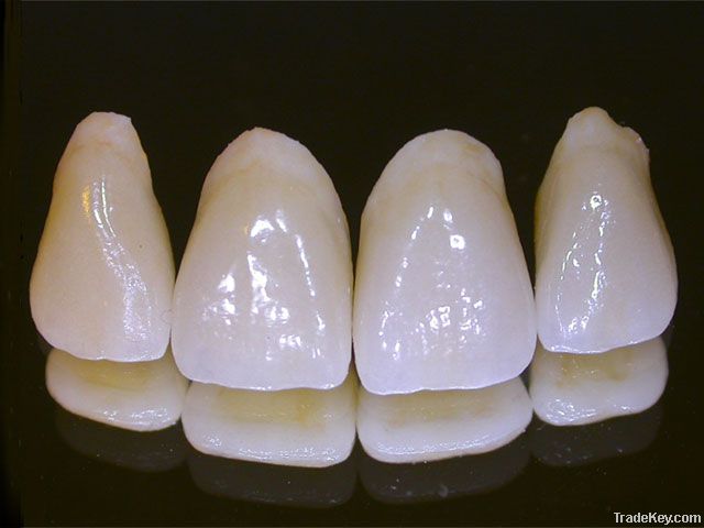 dentures teeth Dental Porcelain Fused to Metal Crown/Bridge