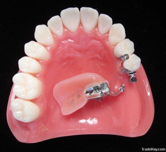 dental Precision Attachments Restoration for Teeth