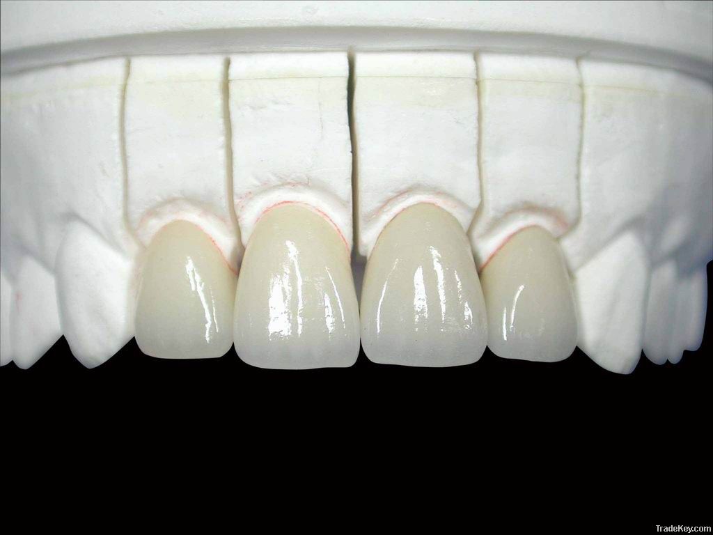 Dental Restoration All Ceramic Crown