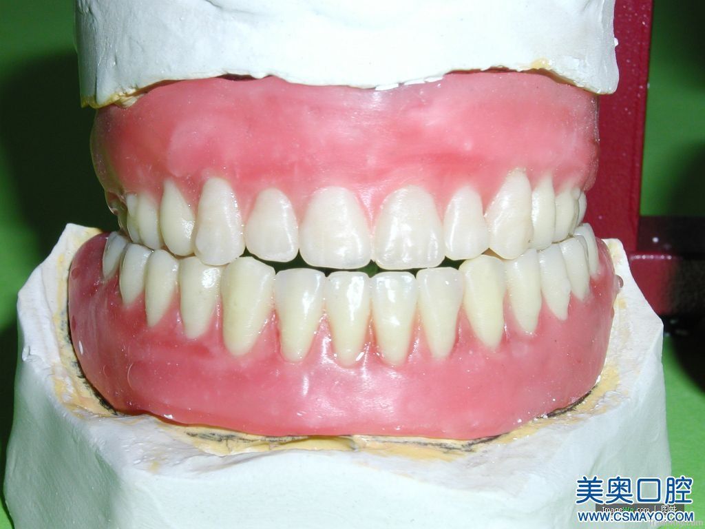 Dental Half/ Full mouth Denture