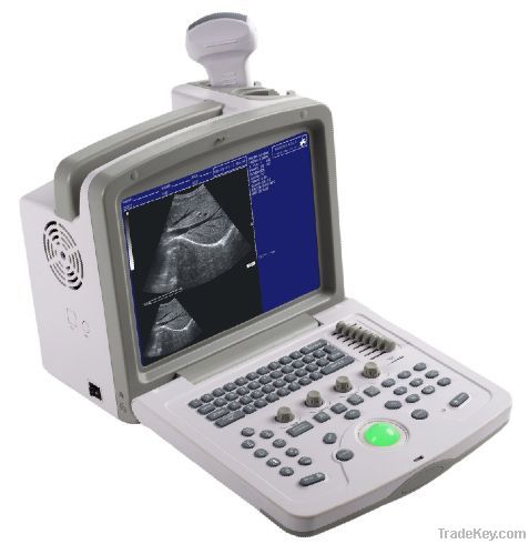 Portable black and white ultrasound system