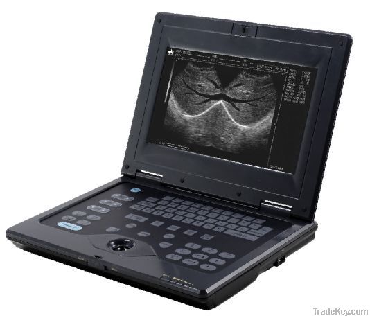 Laptop black and white vet ultrasound system