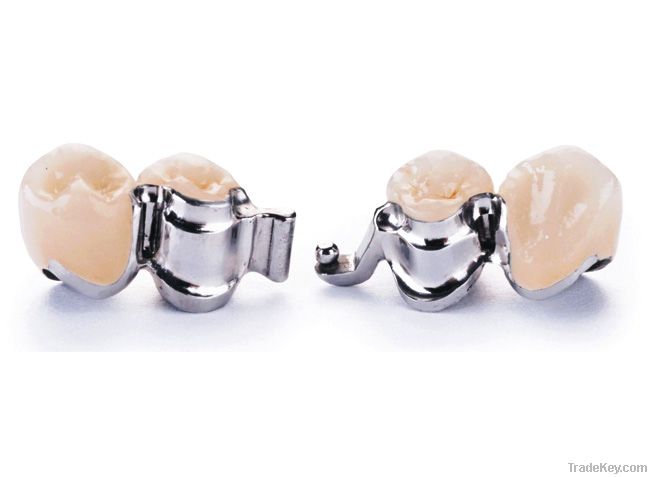 Precision Dental Attachment