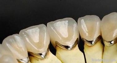 Dental Porcelain Fused to Metal  PFM Co-Cr Crow and bridge Fixed Resto