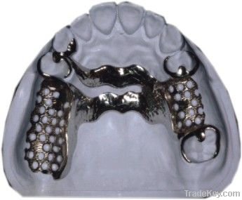 Metal Framework Vitallium Framework Dental Removable Restoration