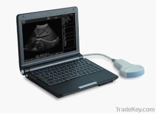 Laptop ultrasound scanner