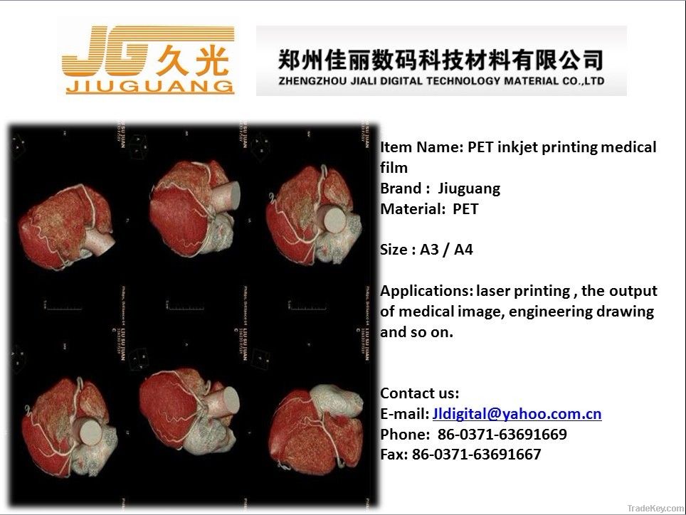 PET inkjet printing medical image film