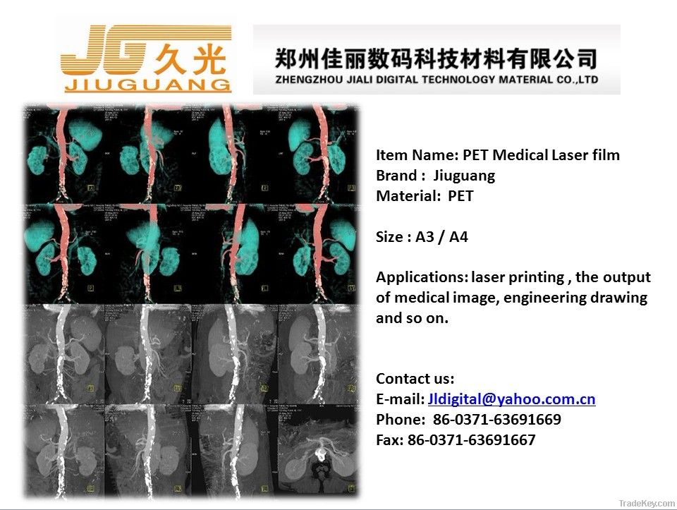 PET Lazer printing medical image film