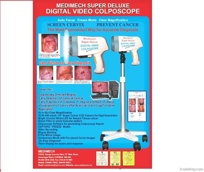 Digital video colposcope