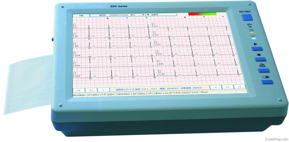 Electrocardiograph System (ECG)