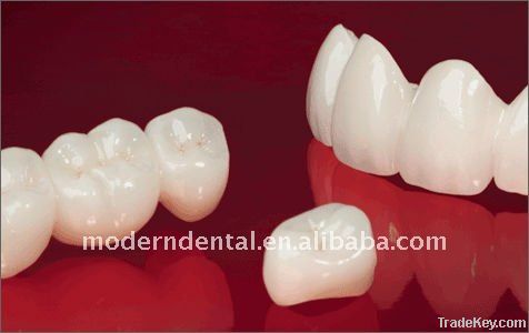 Dental all-ceramic zirconia inlay&amp;amp;amp;amp;onlay&amp;amp;amp;amp;veneer supplier