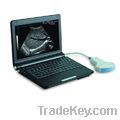 Laptop Ultrasound Machine Scanner System Digital with One Probe Connec