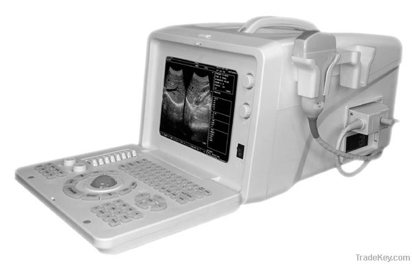 SS-5Plus Ultrasound Imaging Systems(ultrasound, ultrasoni, black white, s