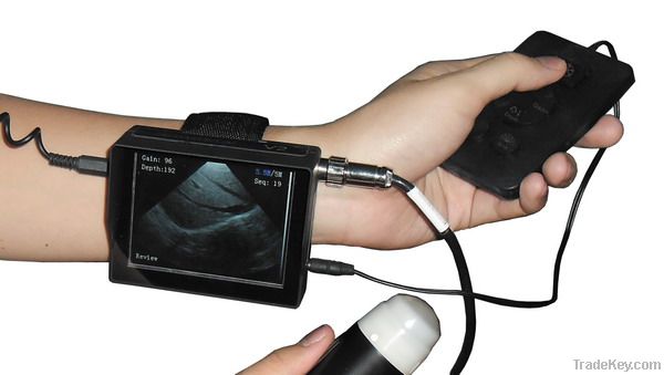 V2 Veterinary Wrist Ultrasound Scanner