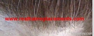 hair replacements   men's toupee