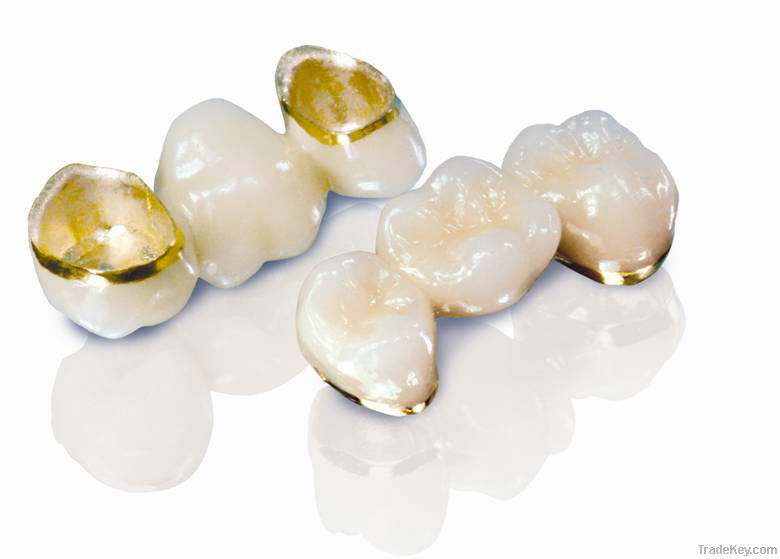 Dental Captak / Precious high noble porcelain metal crown