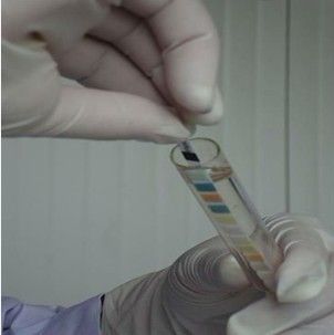 Reagent strips for urinalysis