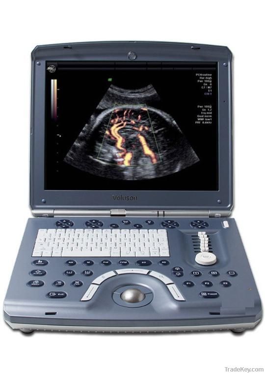 GE Ultrasound machine Voluson e