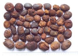 GALLSTONE FOR SALE 