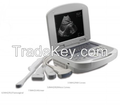 notebook ultrasound scanner with convex probe Dolphipro 