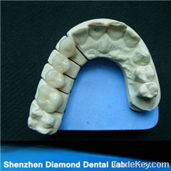Dental Zirconia crowns and bridges