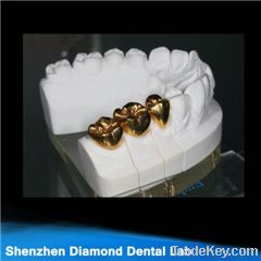 Dental (non) precious metal crowns