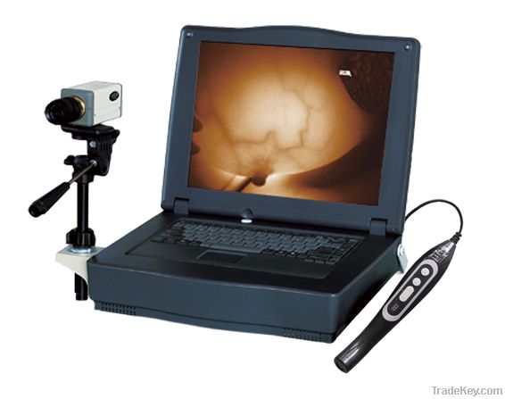 infrared mammary diagnostic apparatus