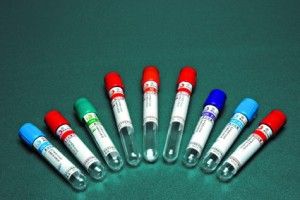 Vacuum blood collection tube