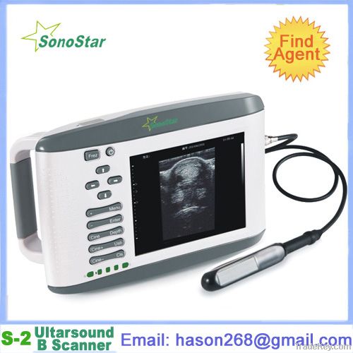 SS-2V Veterinary Ultrasound B Scanner(ultrasound, ultrasoni, black wh